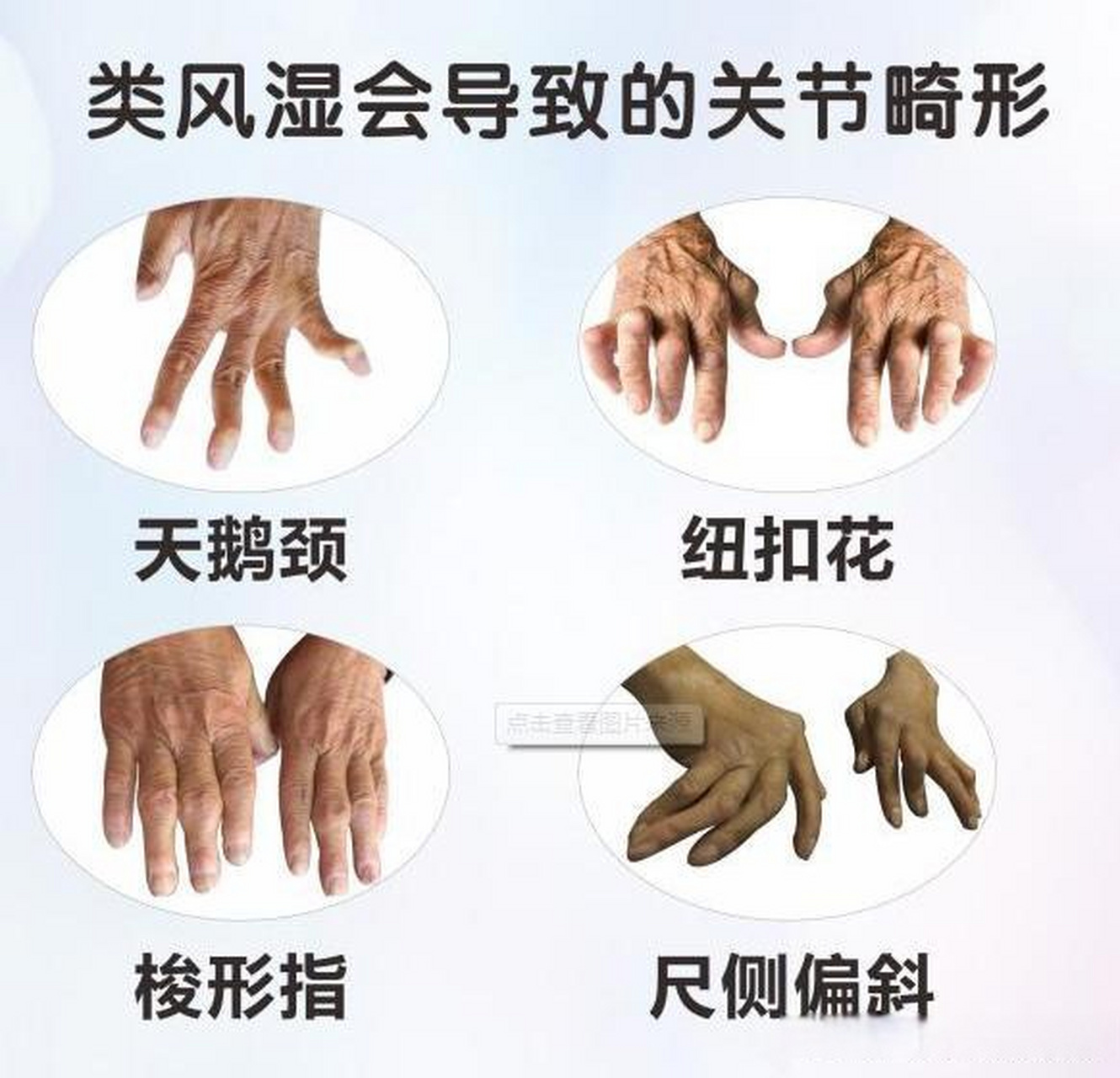 分享一张治疗风湿类风湿的良方,特别适合怕冷,疼痛,麻木的人  今天想