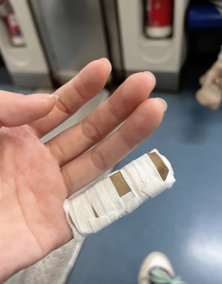 如果骨折发生在手指
