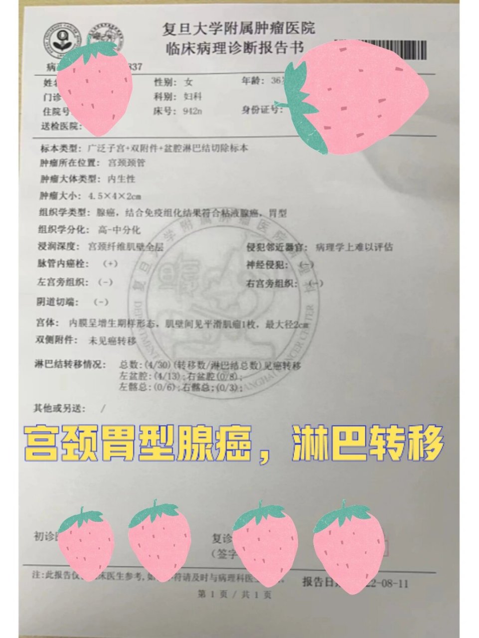 宫颈胃型腺癌,淋巴转移 虽然自己有心理准备,但看到病理的那一刻,还是