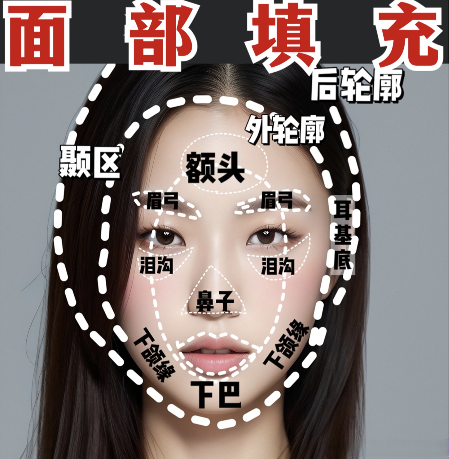 西安下颌角# 面部比例与协调性