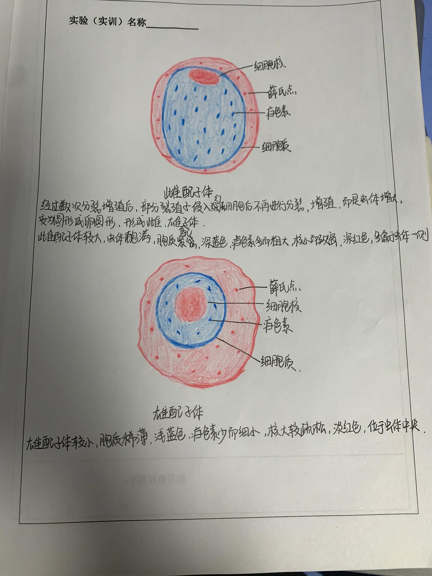 间日疟原虫红内期图片