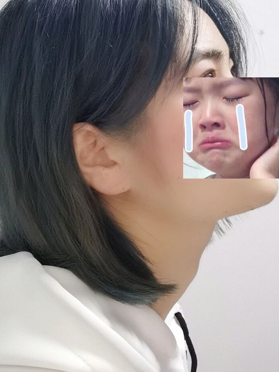 女生长喉结是不是不正常? 各位刘亦菲们!