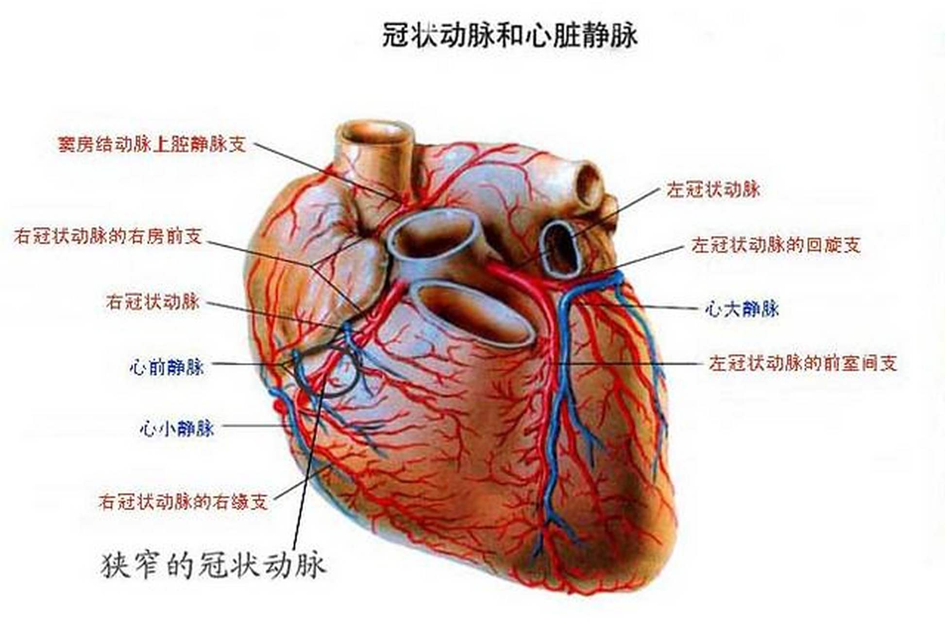 冠状动脉的轻微狭窄可以诊断为冠心病吗?