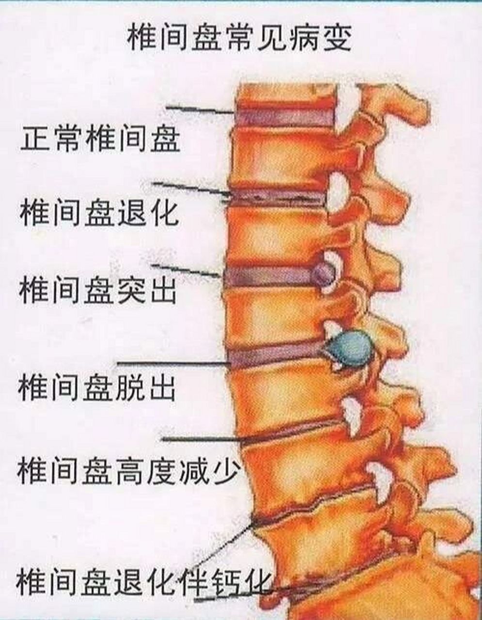 腰椎体图片