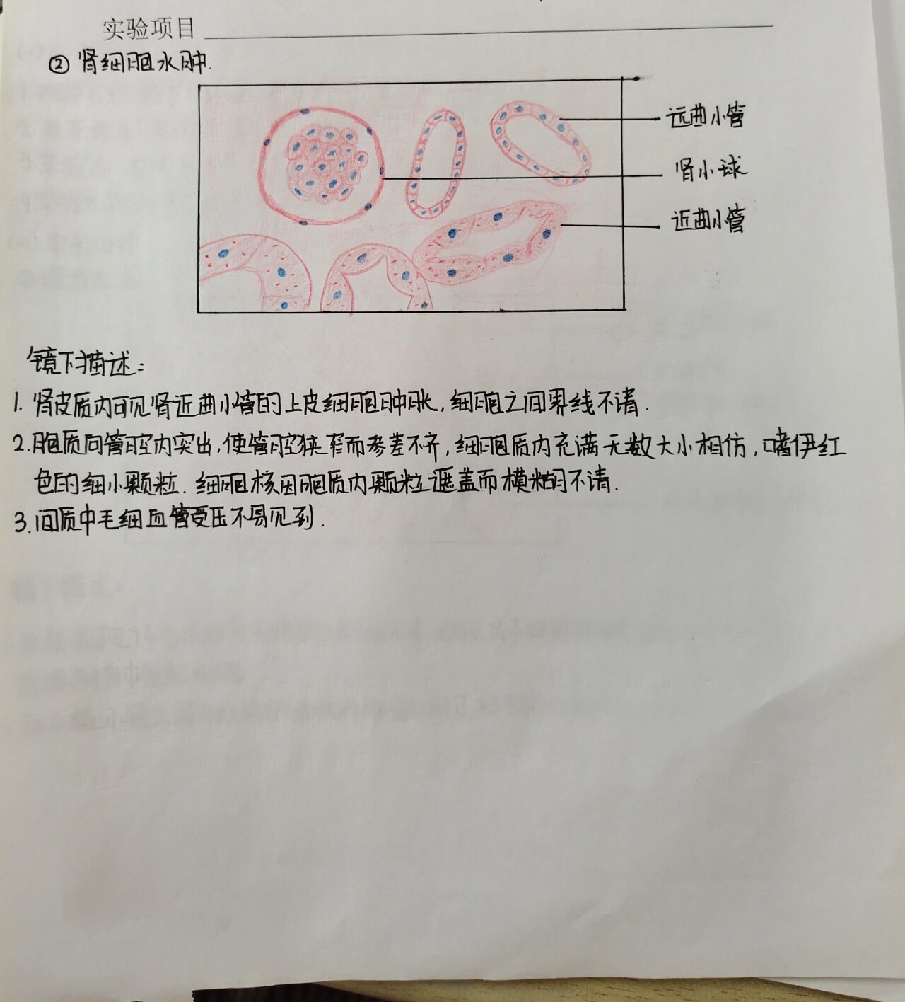 病理实验红蓝铅笔绘图合集 肉芽组织 肾细胞水肿 混合血栓 急性阑尾炎