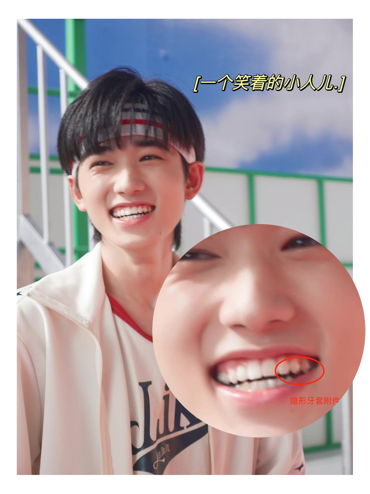 盘点97牙齿矫正的明星,90%都戴隐形牙套 娱乐圈里的明星 走红的时候