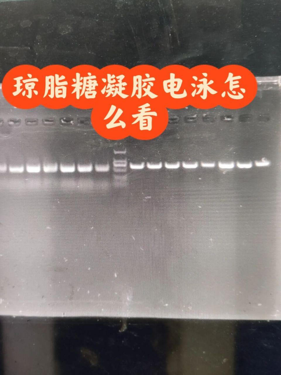 电泳的方向:dna带有负电荷,在琼脂糖凝胶电泳中,在电场力的作用下,由