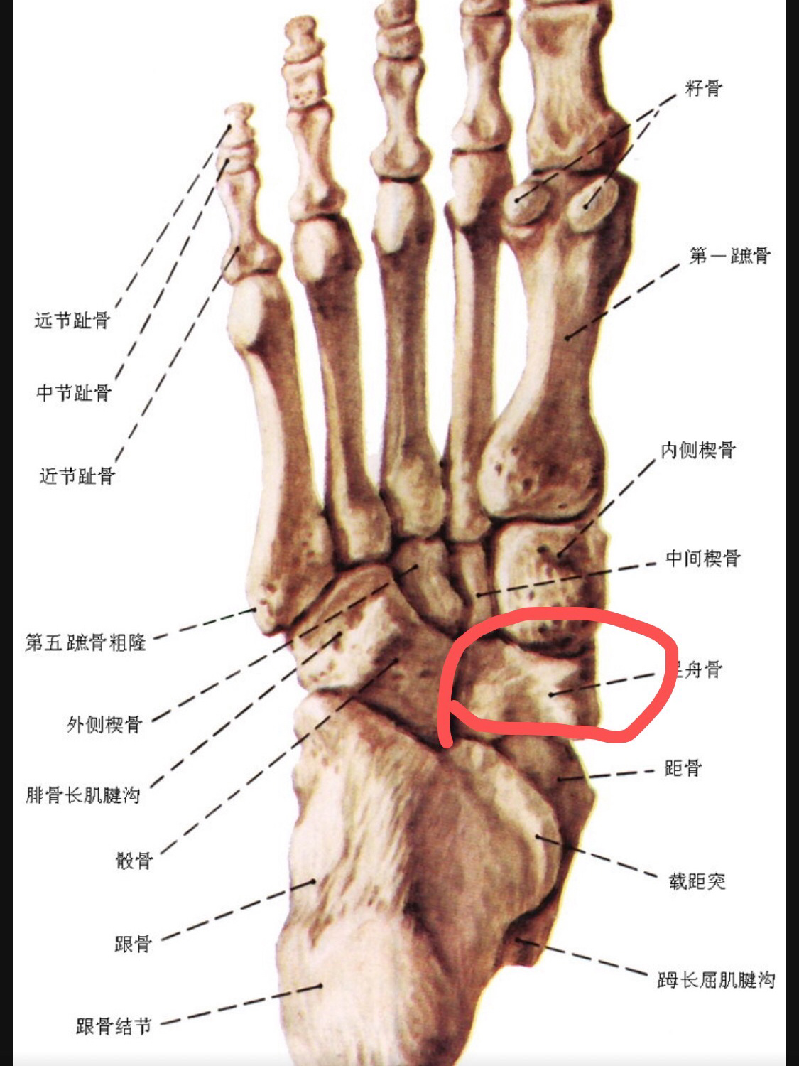 足舟骨是哪个位置图片