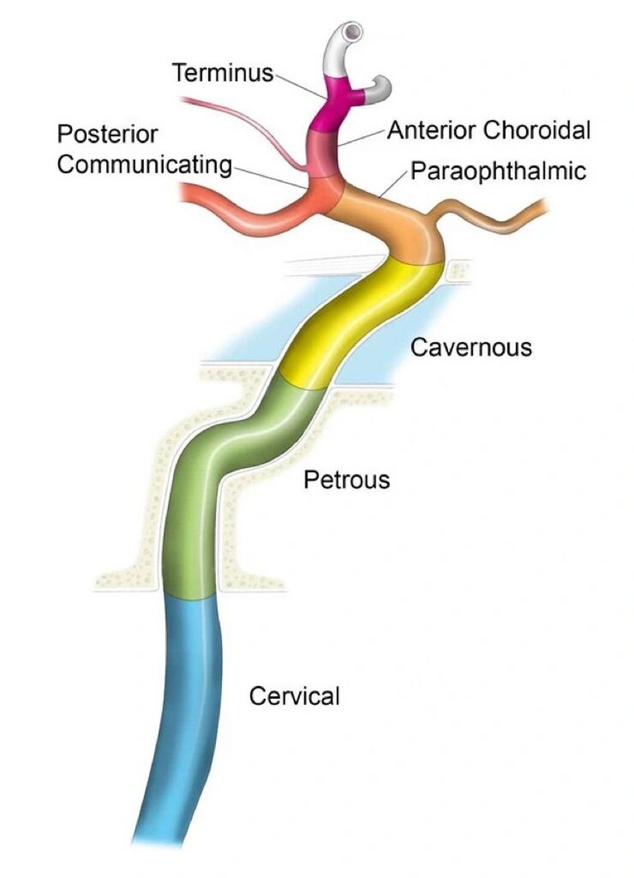 carotid artery图片