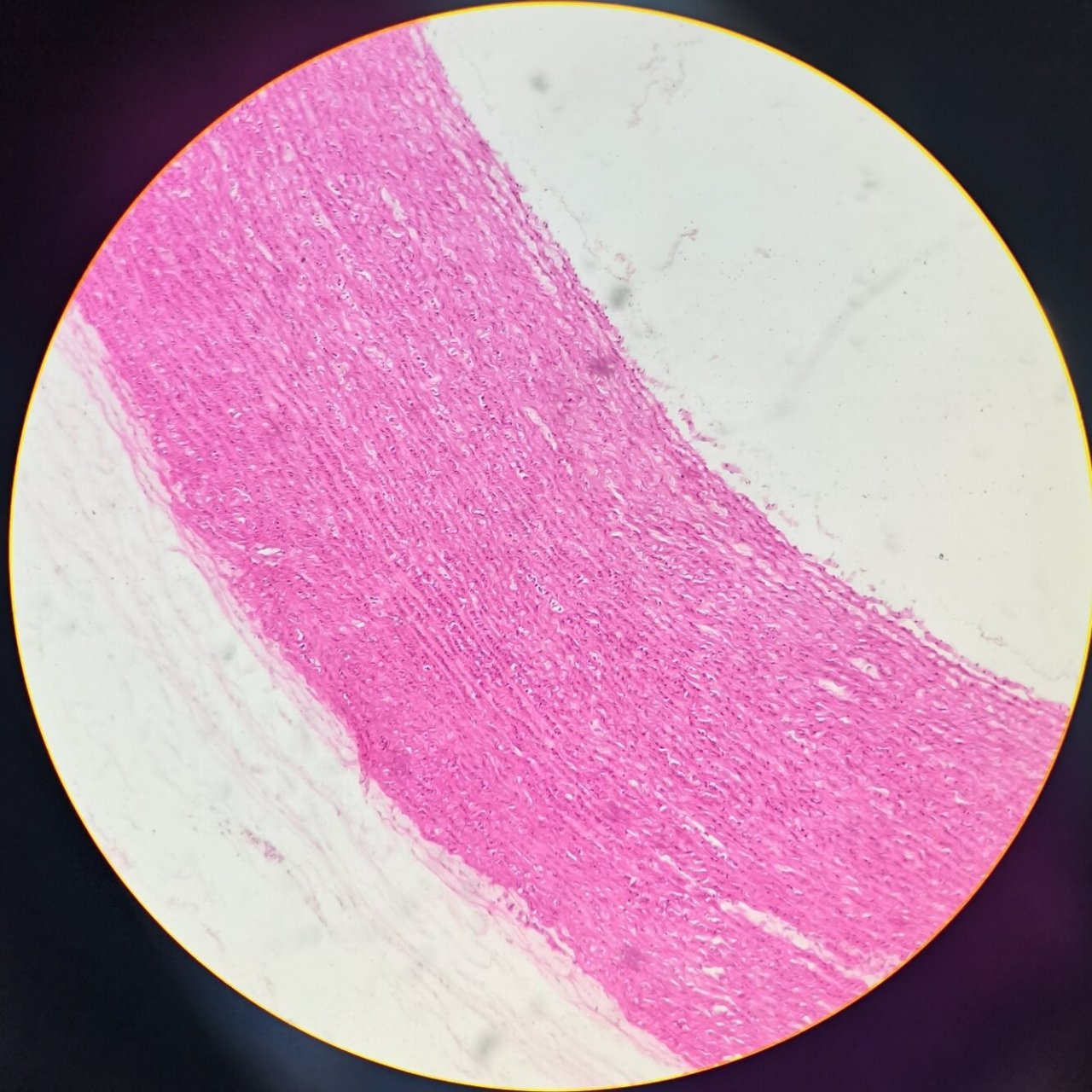 组胚绘图-大动脉 p3 内膜 p4 中膜 p5 外膜 p6-p7 弹性染色