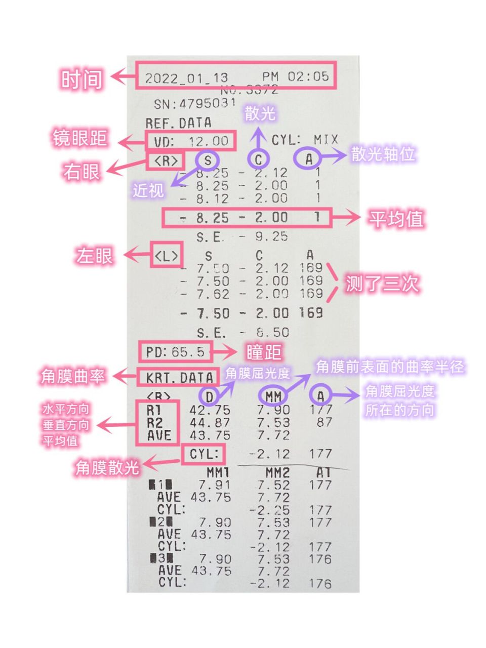 近视手术检查《电脑验光单》怎么看一招教你 很多人在做配镜或近视手
