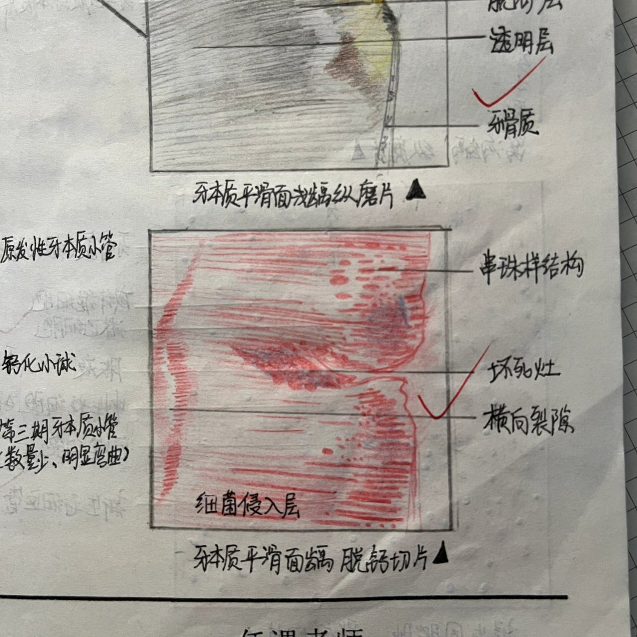 成牙本质细胞突图片