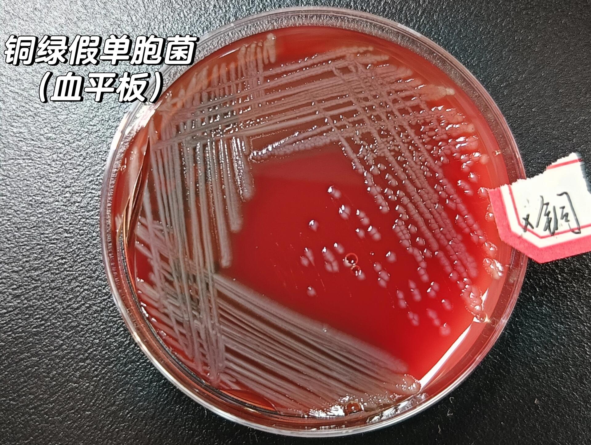 铜绿假单胞菌致病力图片