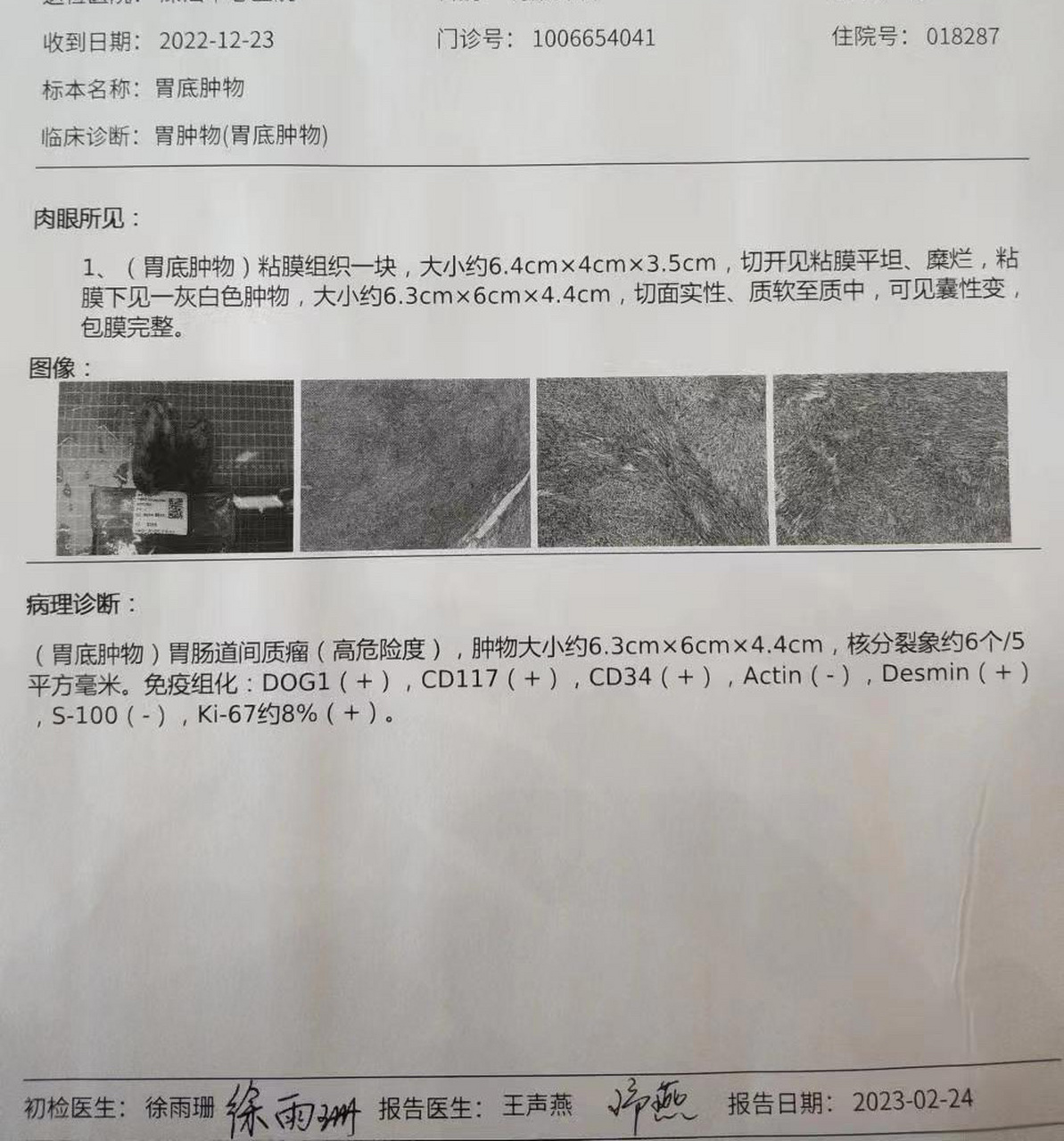 胃间质瘤 整整两个月才出来的病理报告,唉,还是没有等来好消息,也不