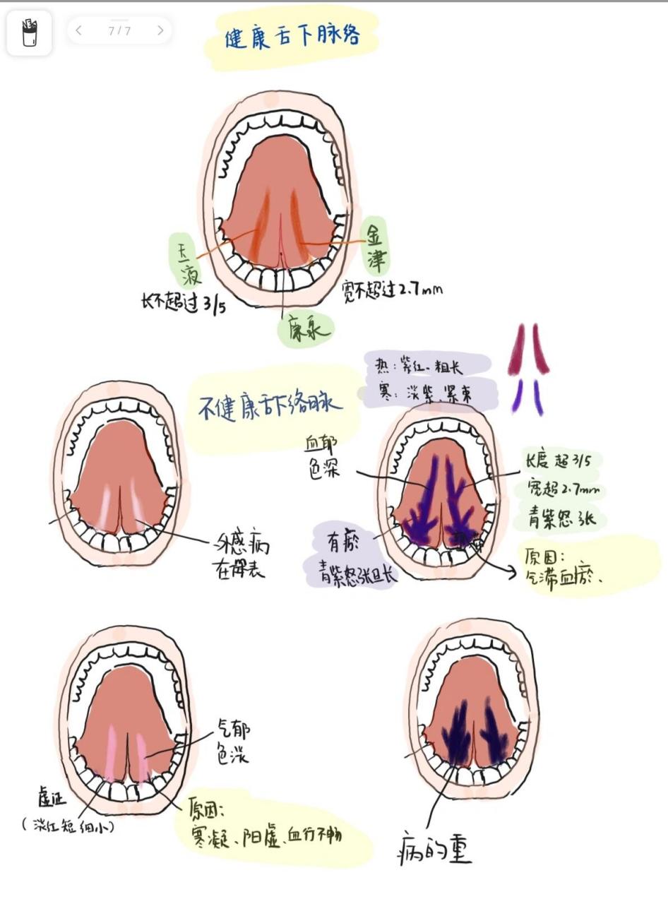 舌诊及舌下脉络图解图片