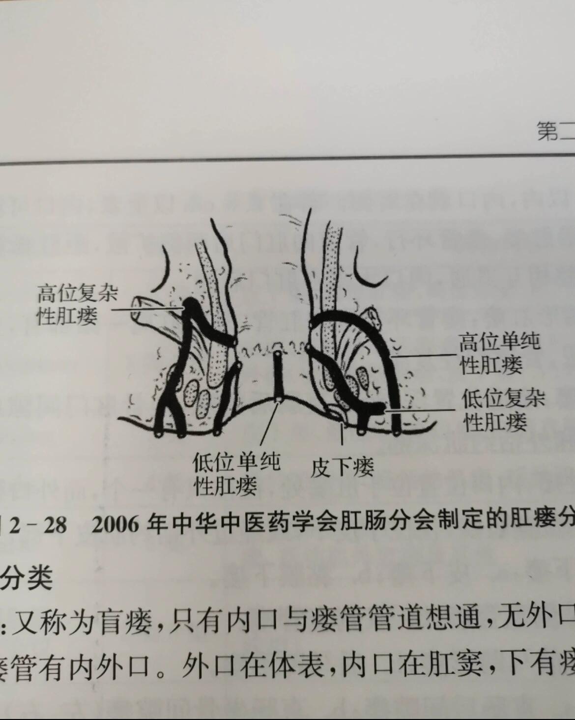 肛瘘…肛瘘…朋友们注意啦!