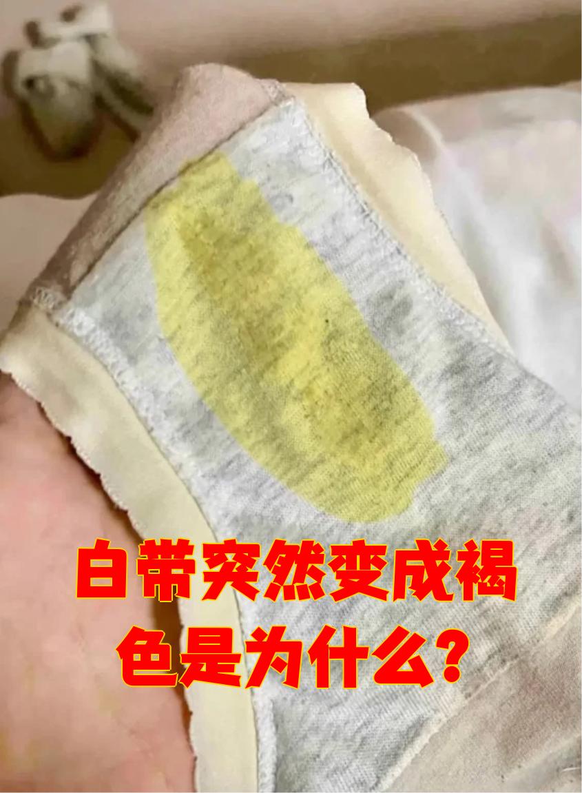 为什么会有褐色白带