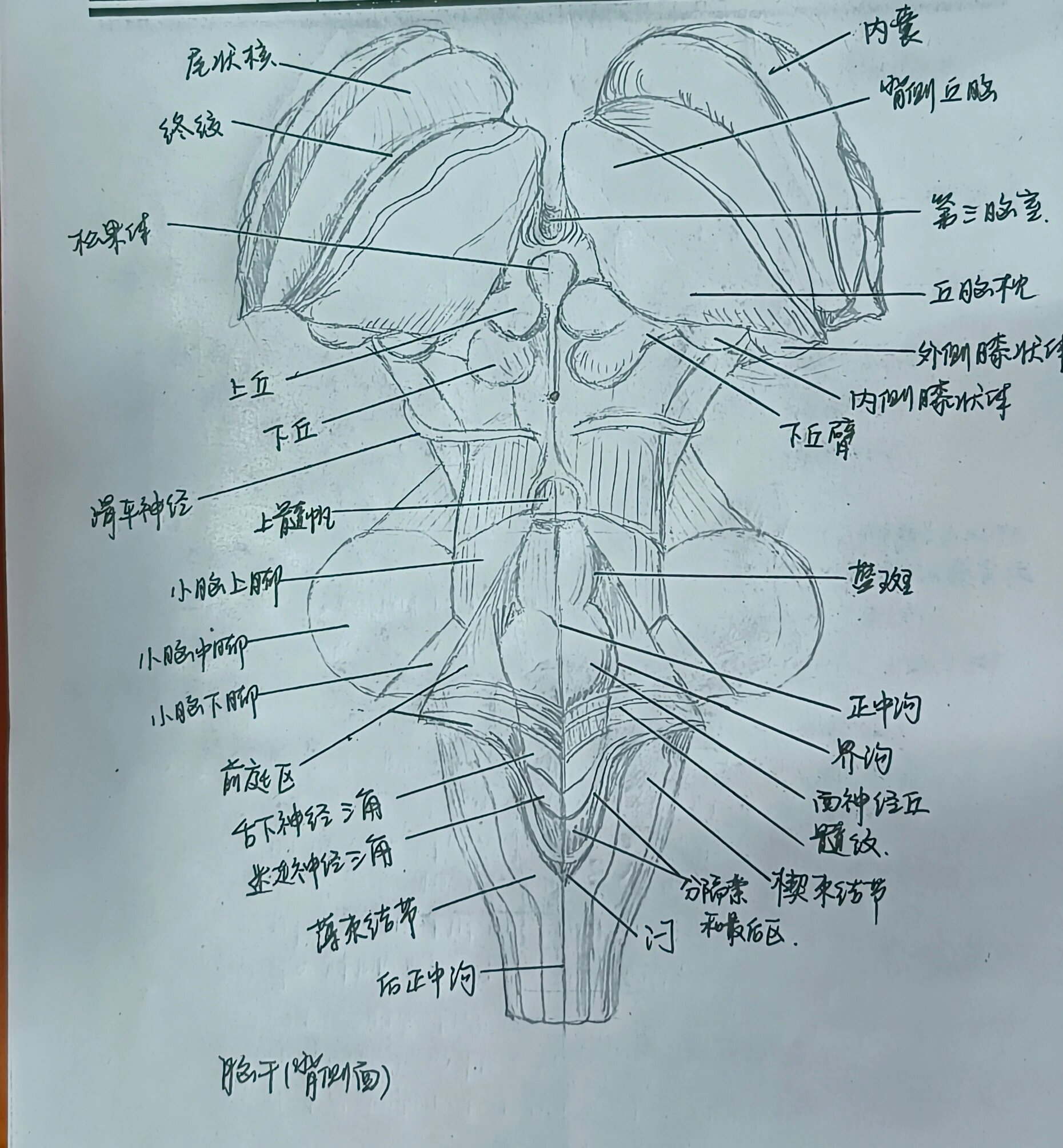 脑干腹侧面的结构图图片