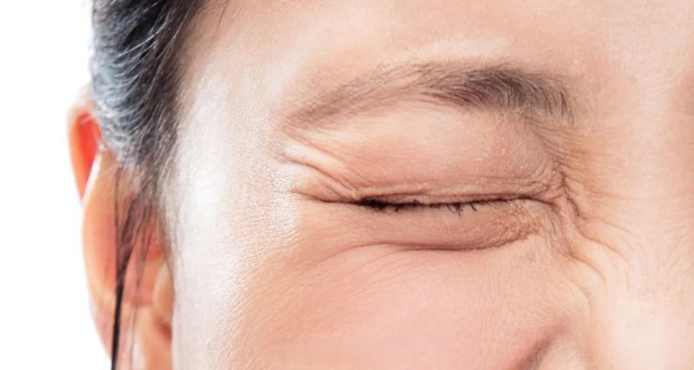 医美[超话] #眼周衰老# #皱纹# 科普贴:为什么眼部容易长皱纹?