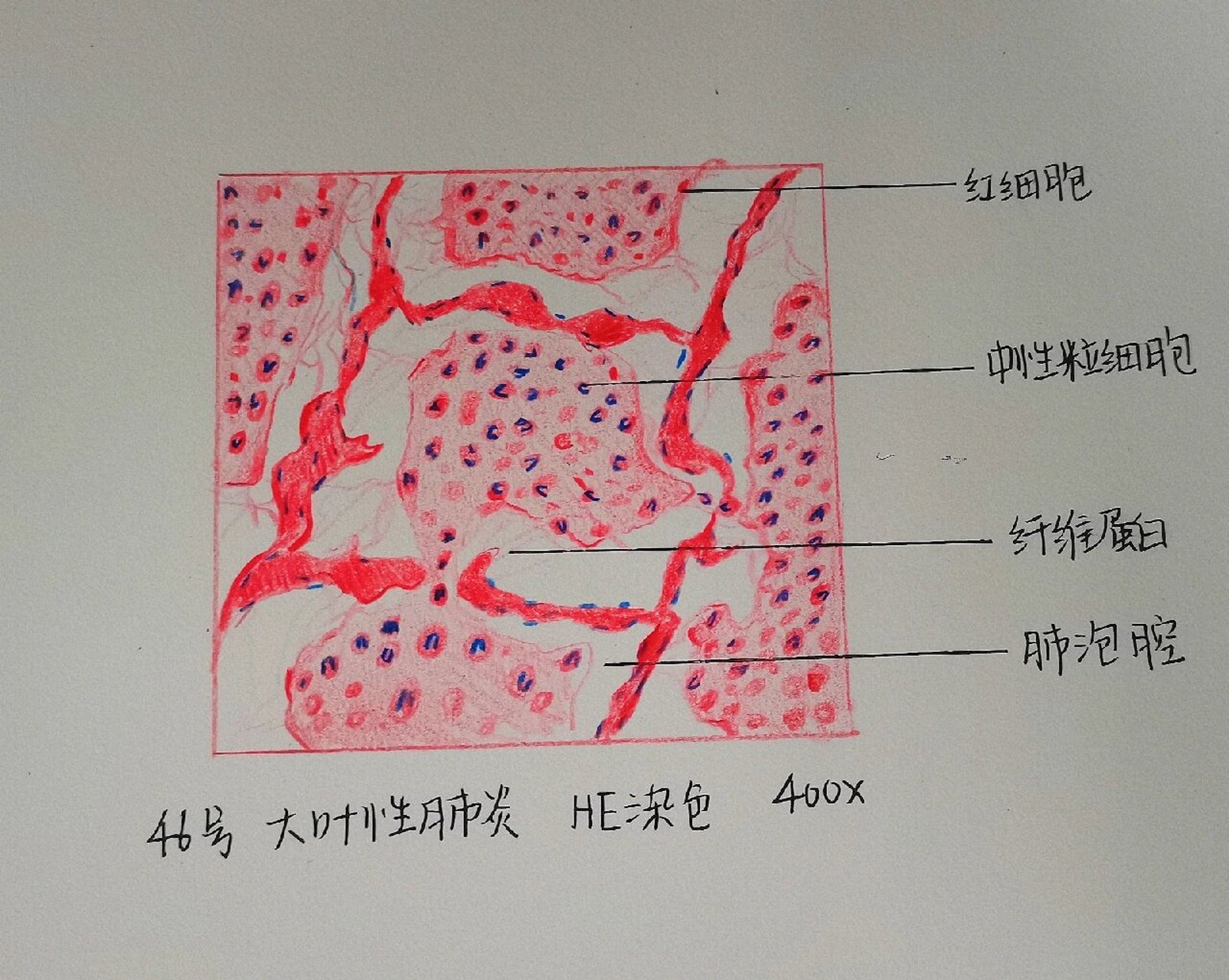 肺炎杆菌手绘图图片