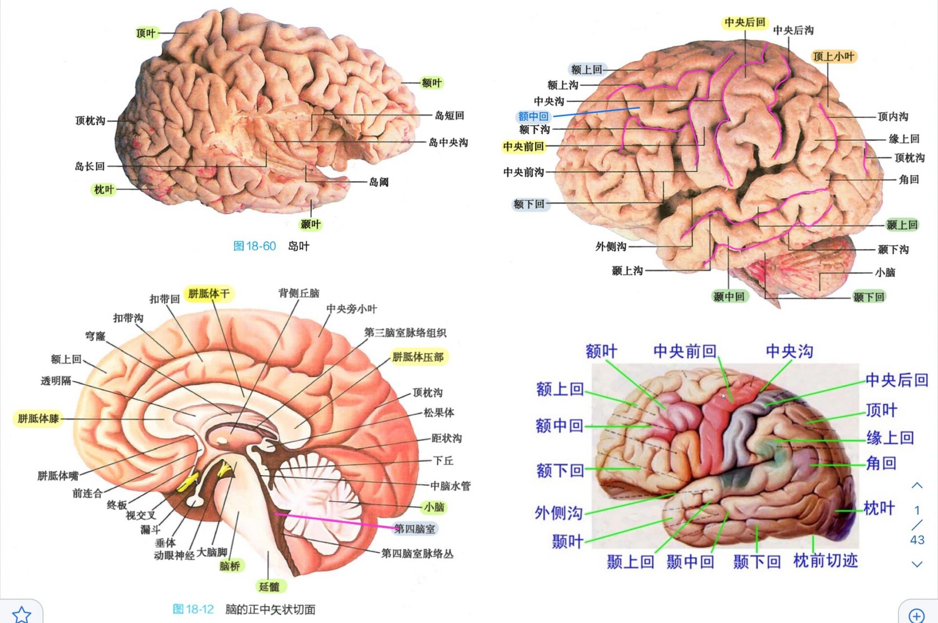 解剖总结 大脑 脑沟脑回 脑室 脑池 大脑横断面解剖 大脑冠状面解剖