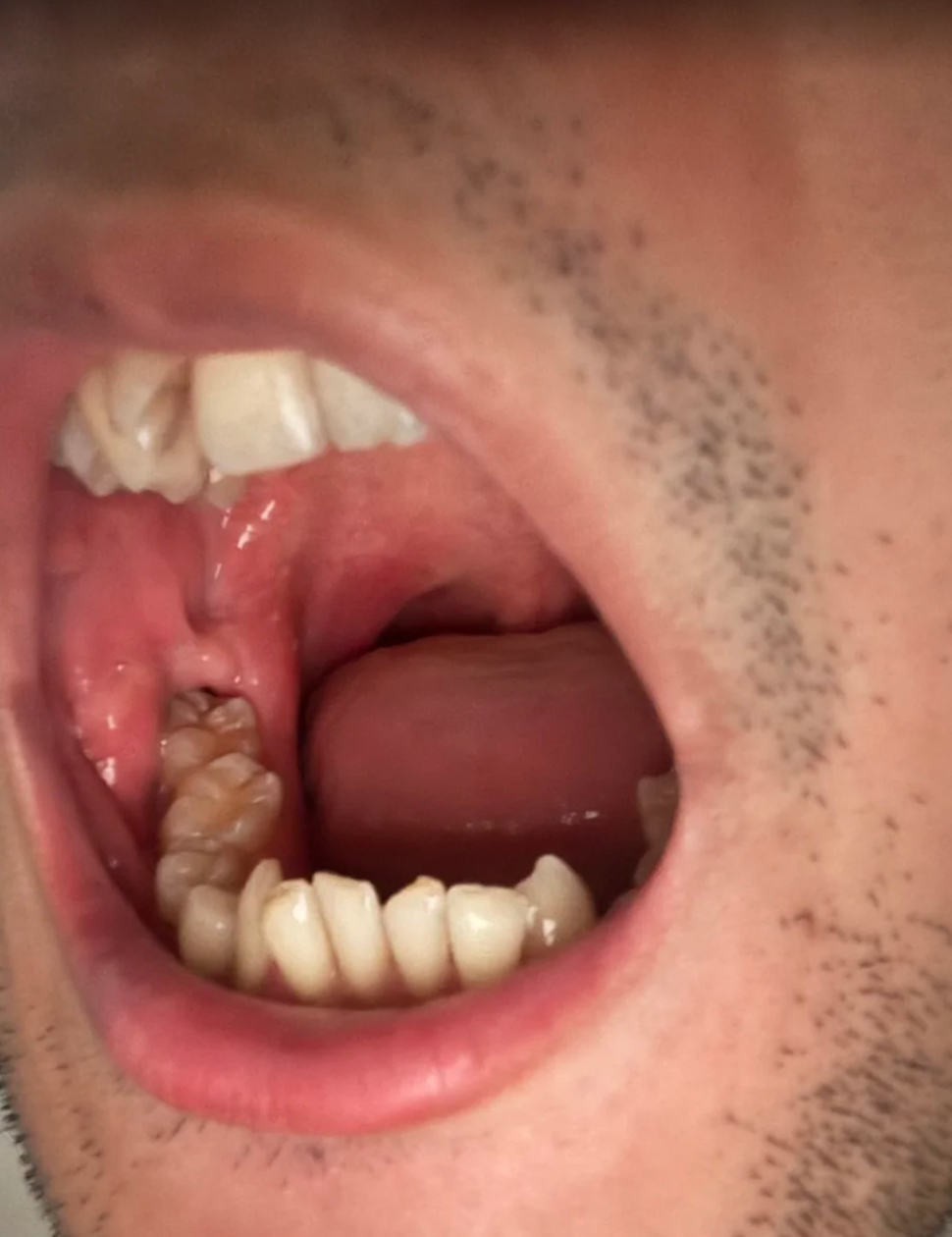 下颌线疼通常是指下颌骨下缘部位的疼痛