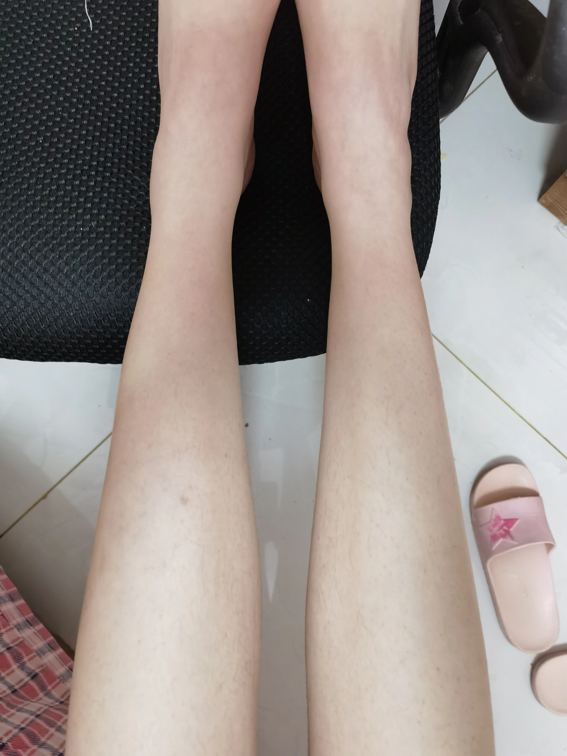 小腿一边有个肿块?