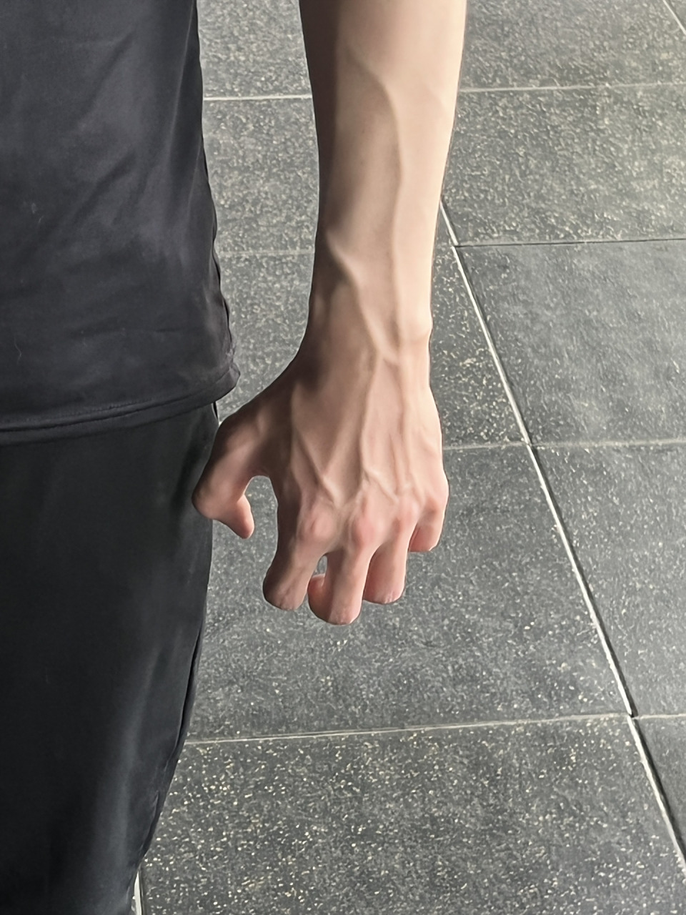 护士最爱的手臂青筋