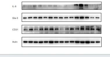 跑了一个星期的wb 了,白介素6死活跑不出来,不是高背景,就是两条目的