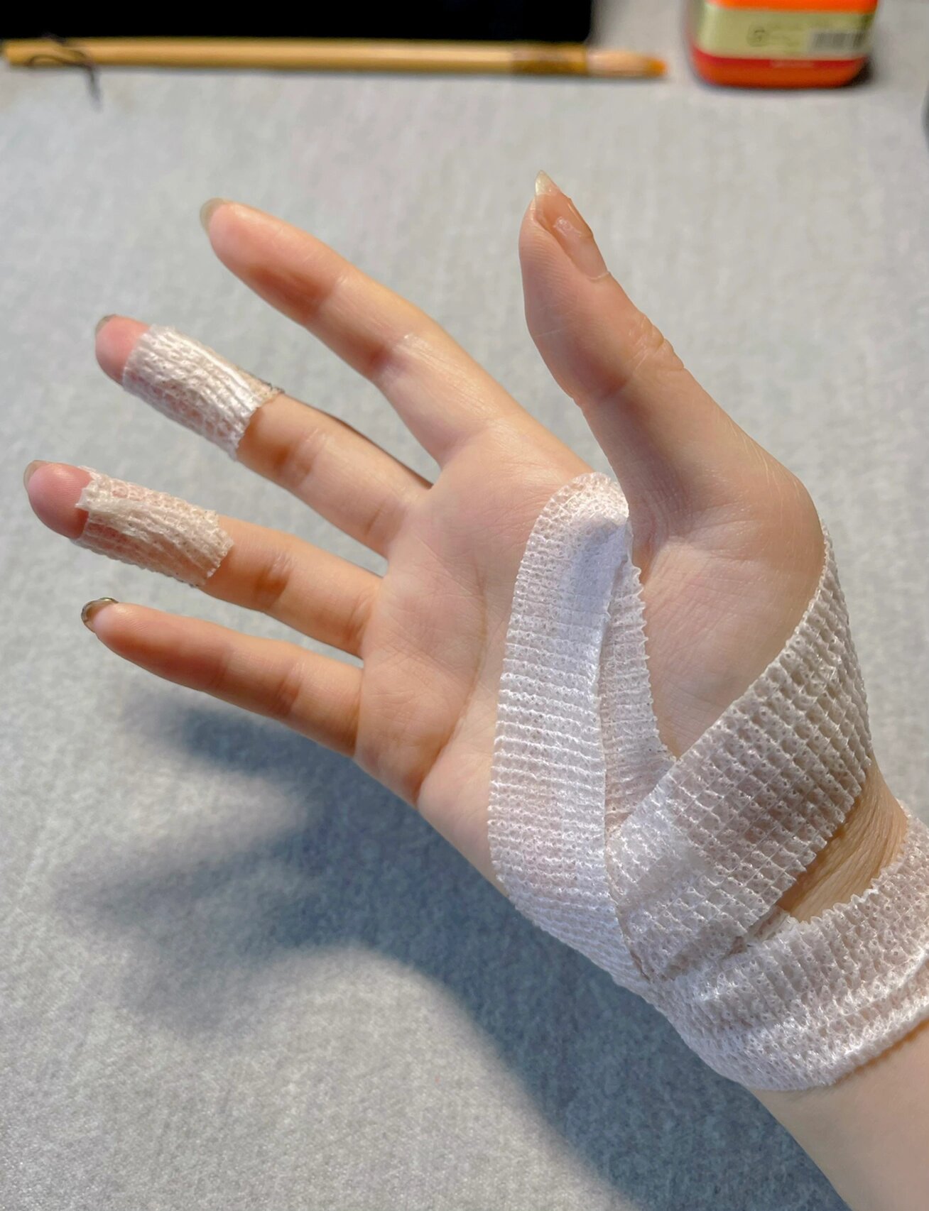 手伤成这样了 不贴膏药举不起手机