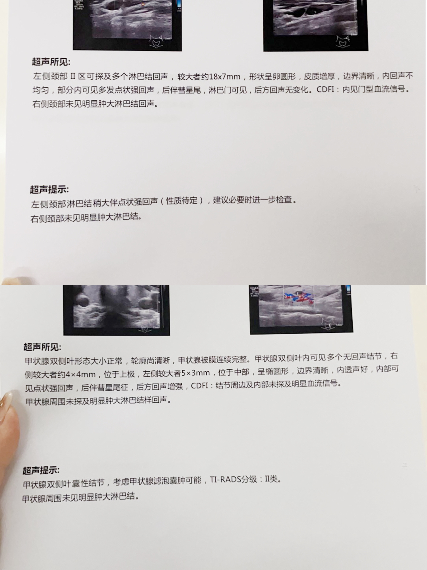 北京大学肿瘤医院穿刺预约-北京大学肿瘤医院穿刺预约要排队几天 北京大学肿瘤医院穿刺预约-北京大学肿瘤医院穿刺预约要排队几天