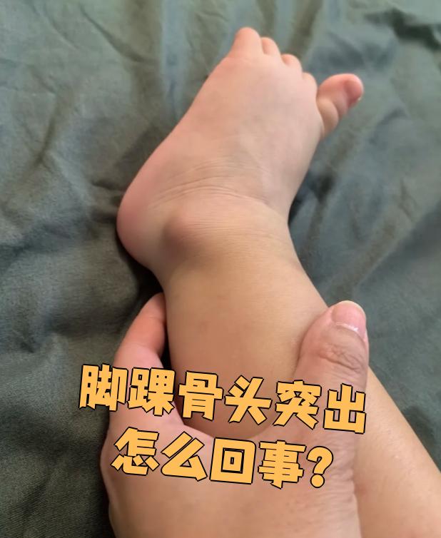 脚踝骨头突出可能由多种原因引起,有的是正常现象,有的则需要治疗