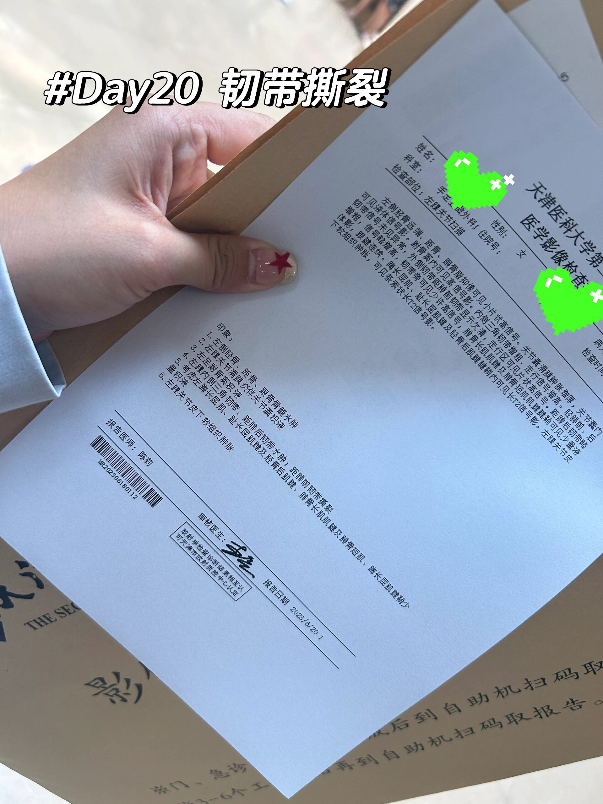 距腓前韧带撕裂 1.