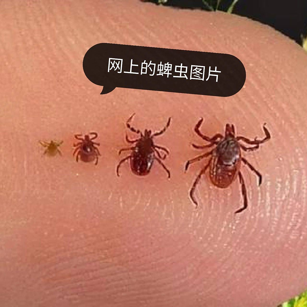 这是什么小虫子,是蜱虫吗?