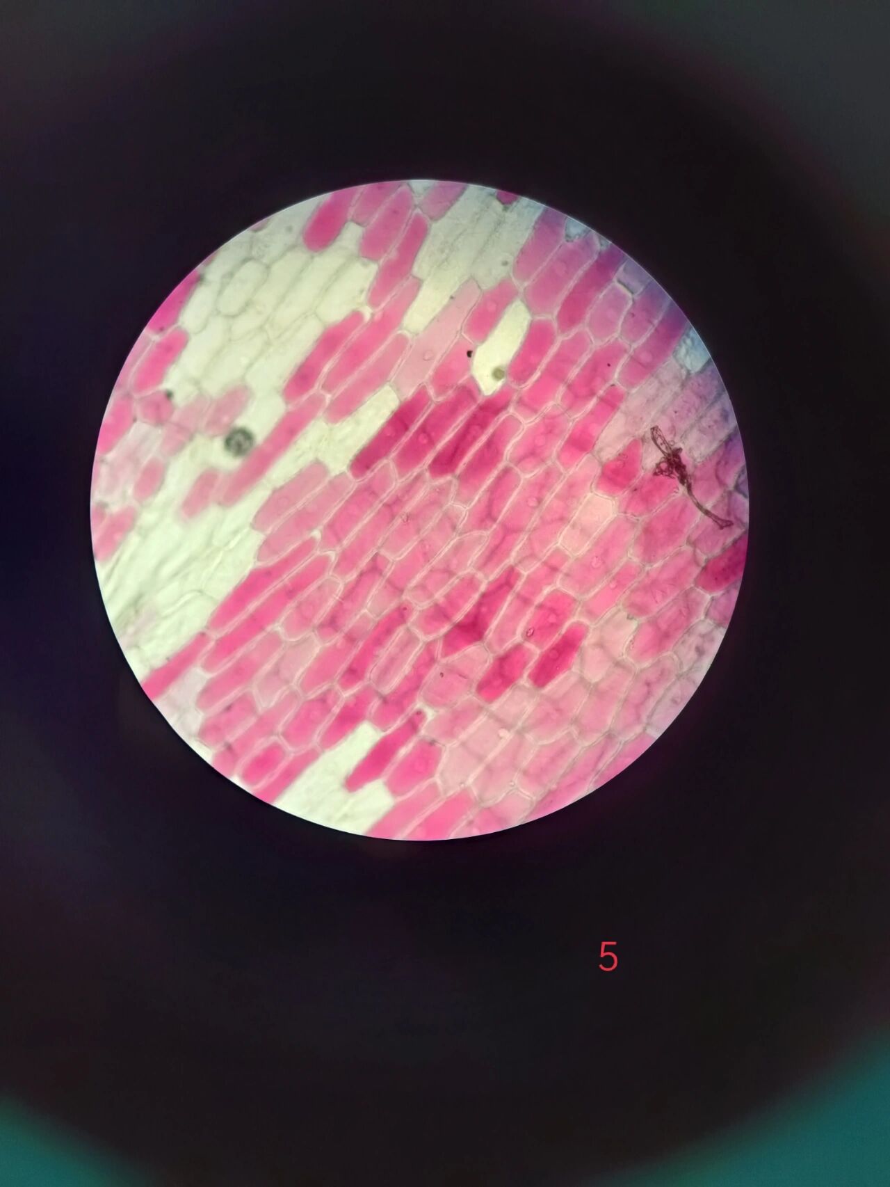 显微镜下的洋葱外表皮发生的质壁分离