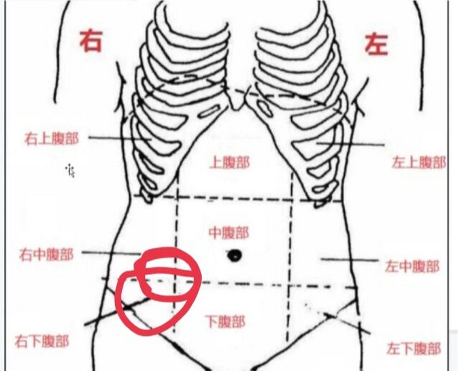 腹部右侧疼痛位置图图片
