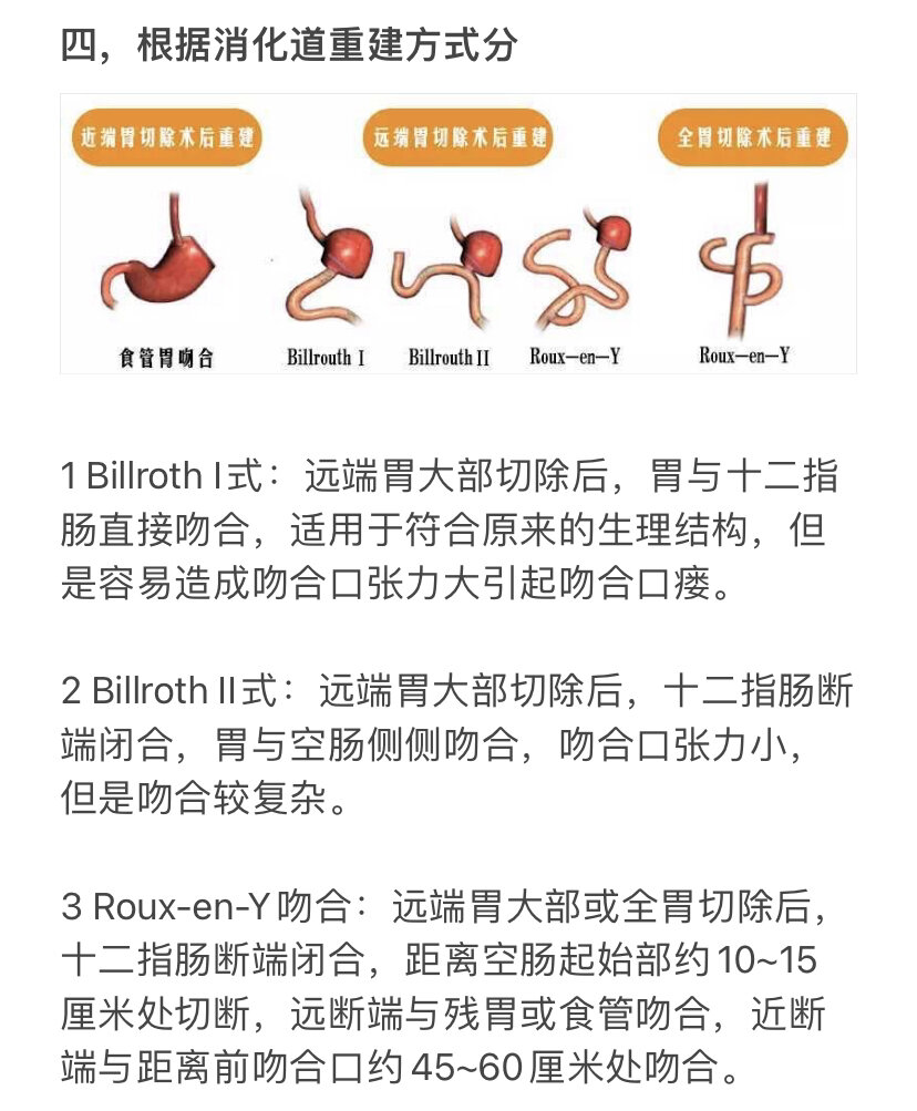 胃癌手术 图解图片