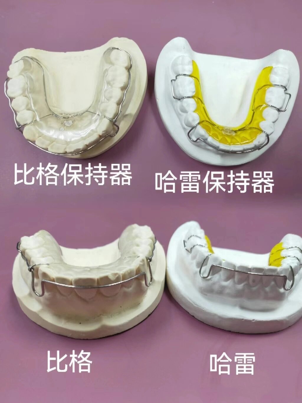 间隙保持器图片种类图片