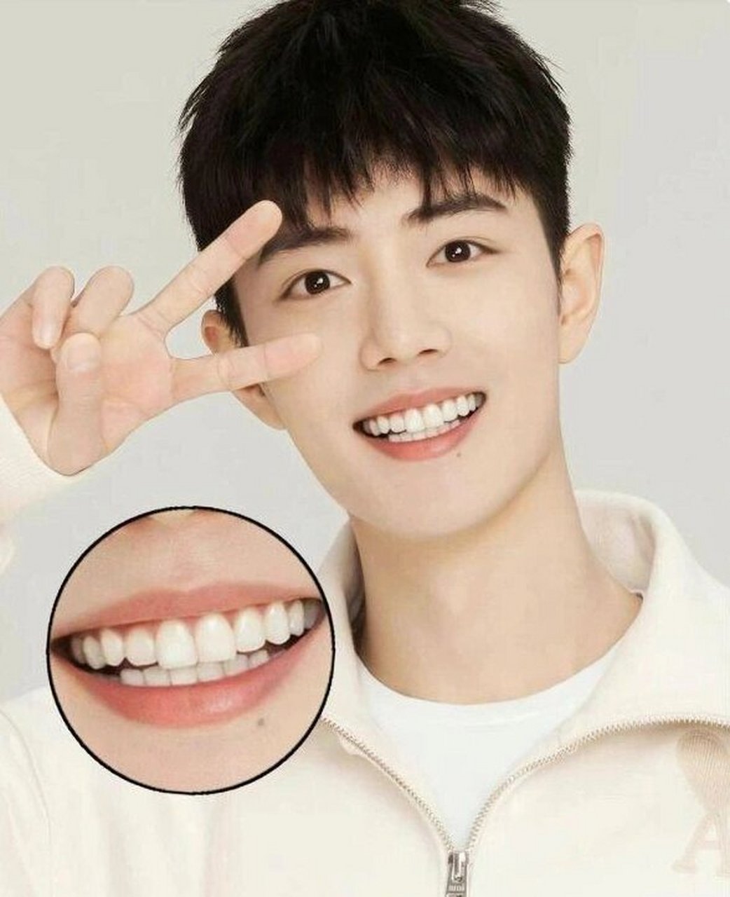 我的健康生活# #牙医日常# #口腔# #牙套# #肖战