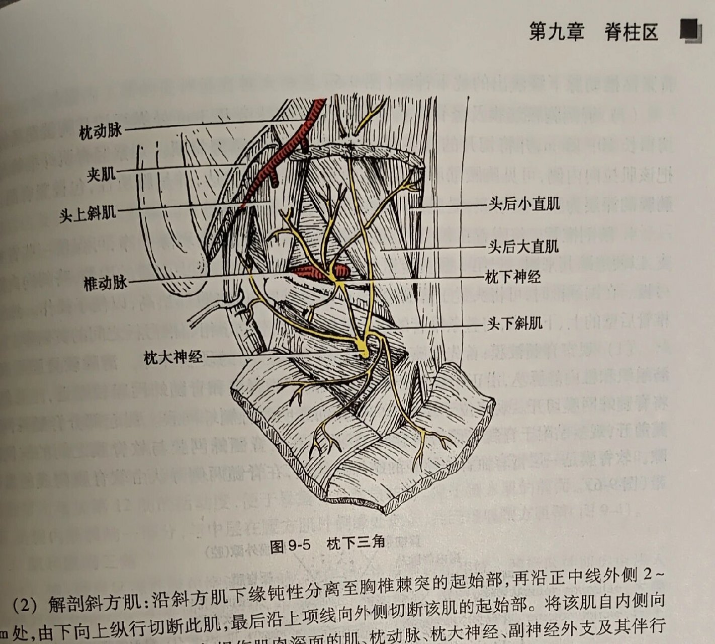 报告脊柱区四个肌间三角 四个肌间三角 1,枕下三角 2,听诊三角 3