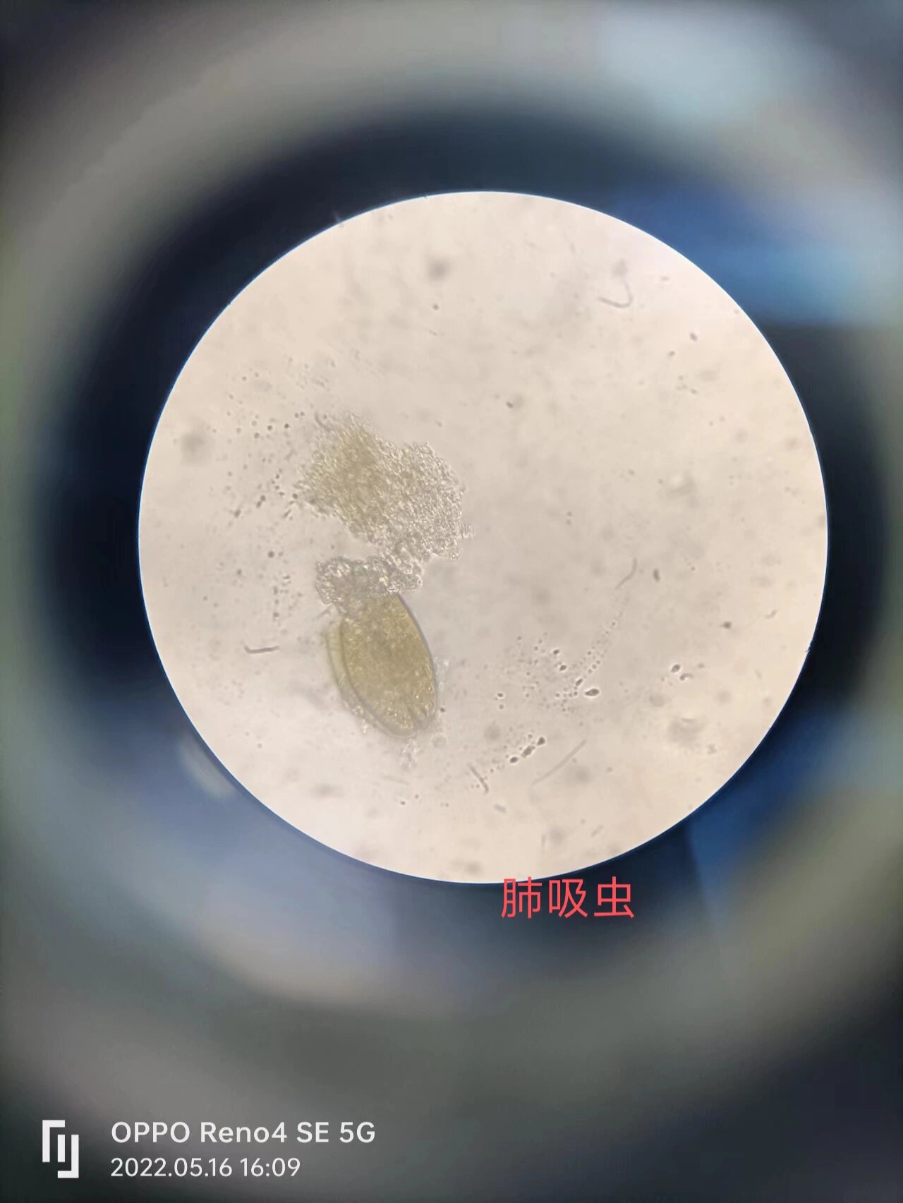 显微镜观察(三) 医学蠕虫    吸虫纲 肝吸虫又称华支睾吸虫 肺吸虫又
