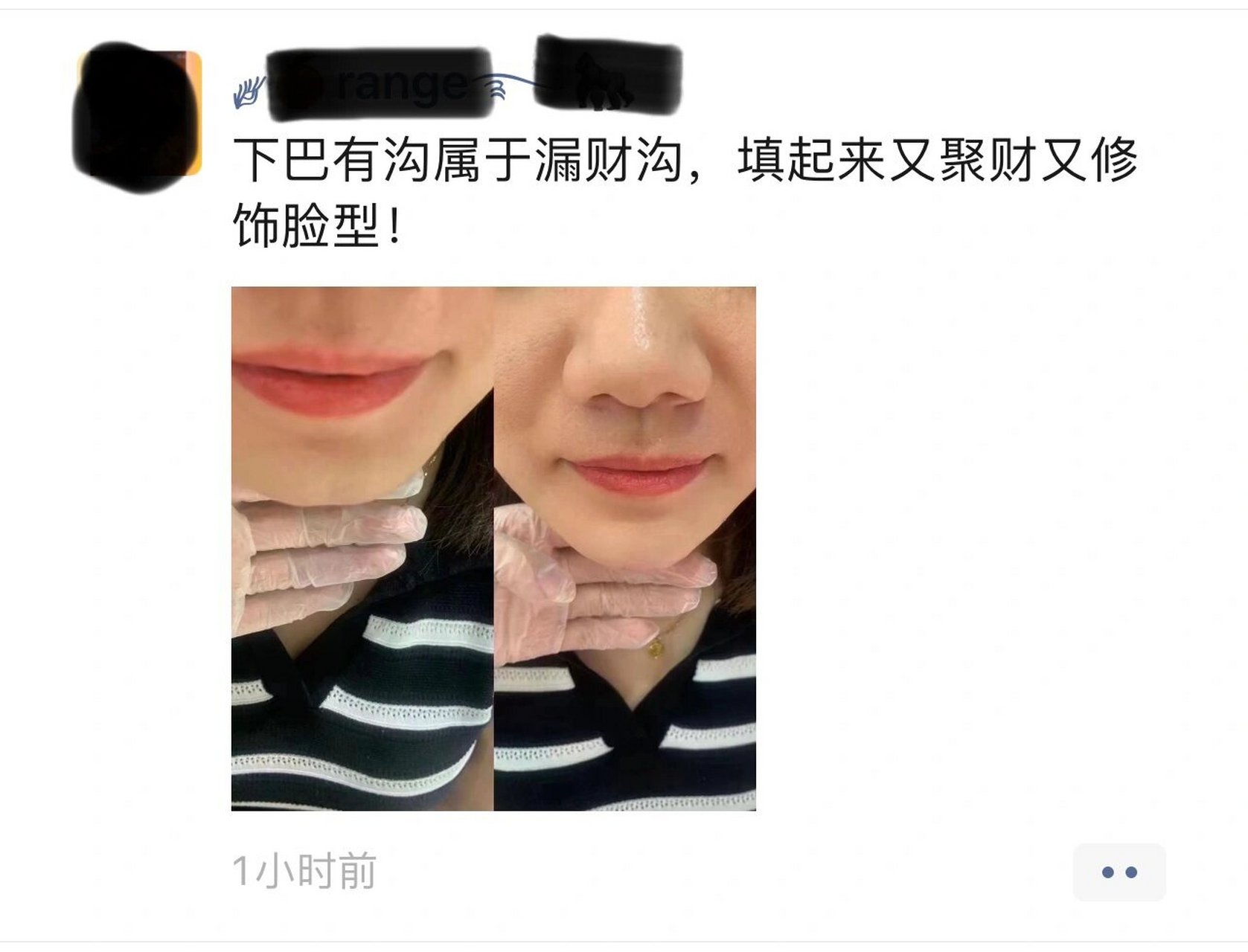 什么样的下巴漏财图片图片