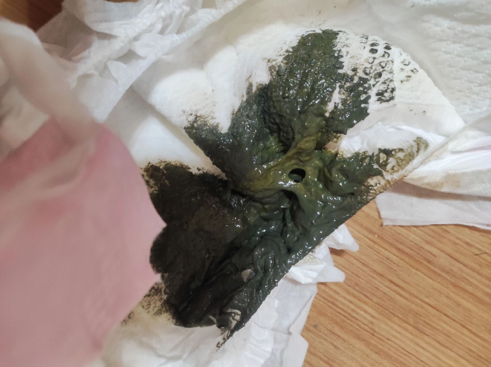 为什么吃氨基酸奶粉,会拉墨绿色粑粑 肠道分泌的胆汁是一种消化液