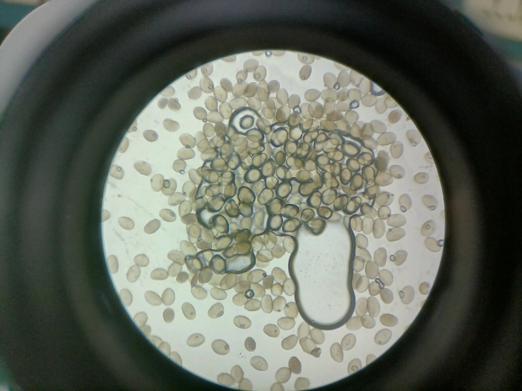 显微镜下的花粉 图一为ttc处理的新鲜花粉,图二图三为