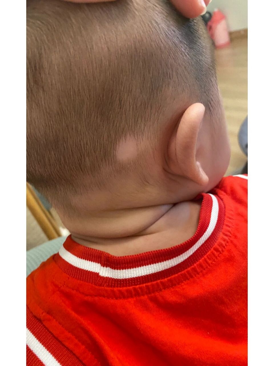 大概3个月多的时候就发现宝宝后脑勺这个地方,有一个小圆地方不长