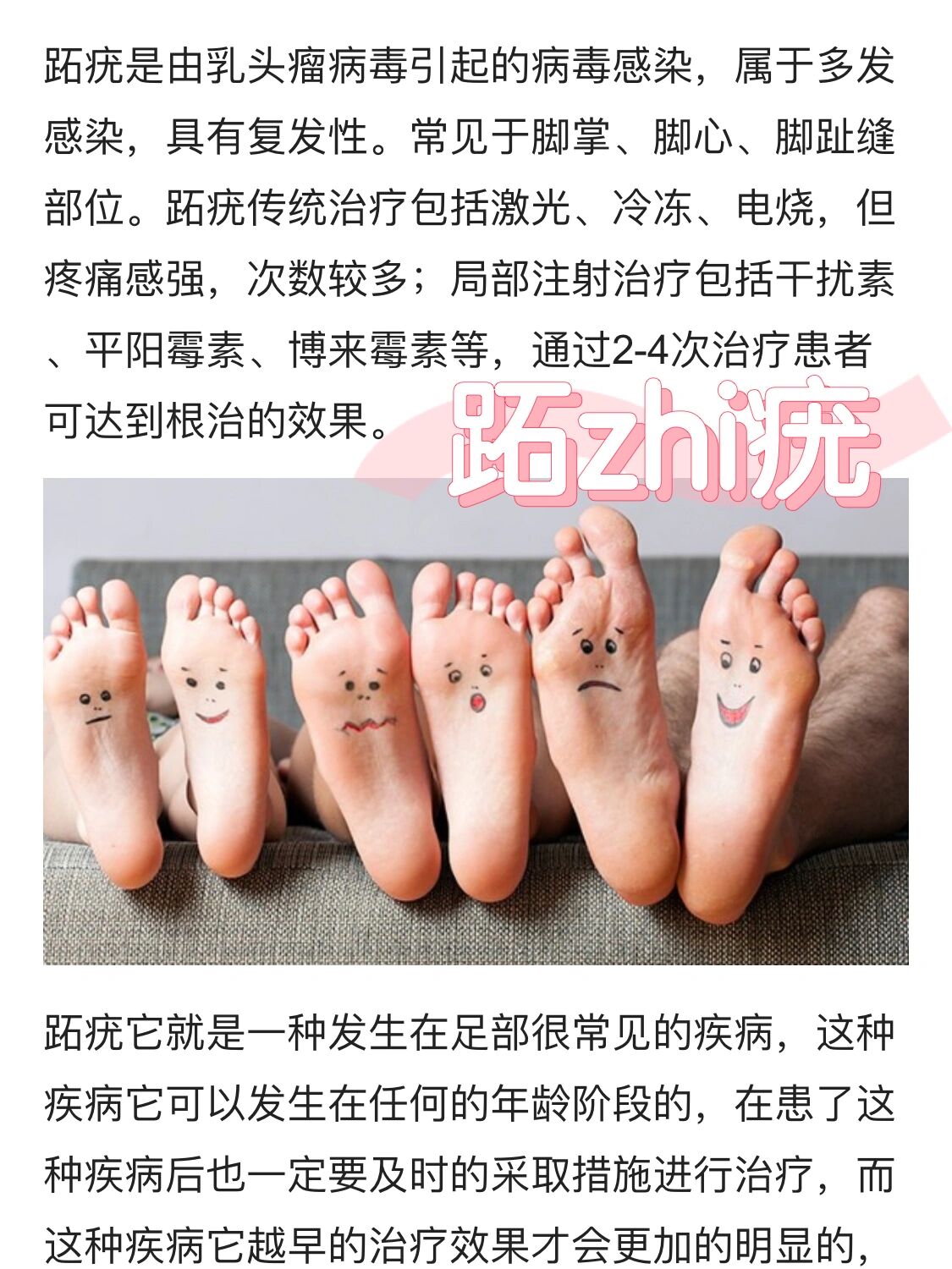 跖疣如何治图片