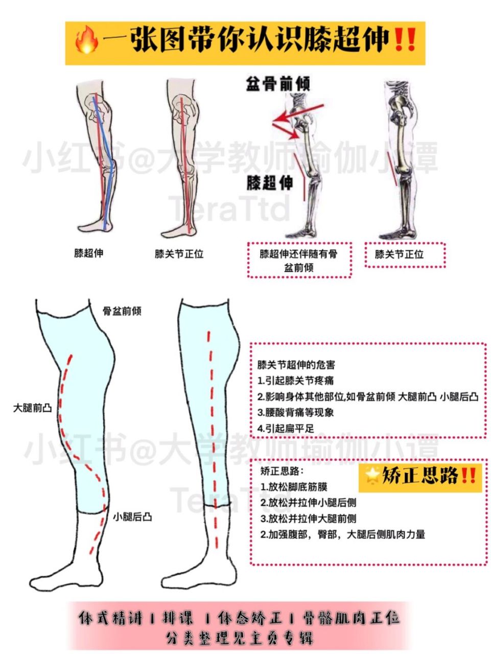 一张图带你认识膝超伸99附膝超伸矫正思路 99 膝关节超伸的危害 1