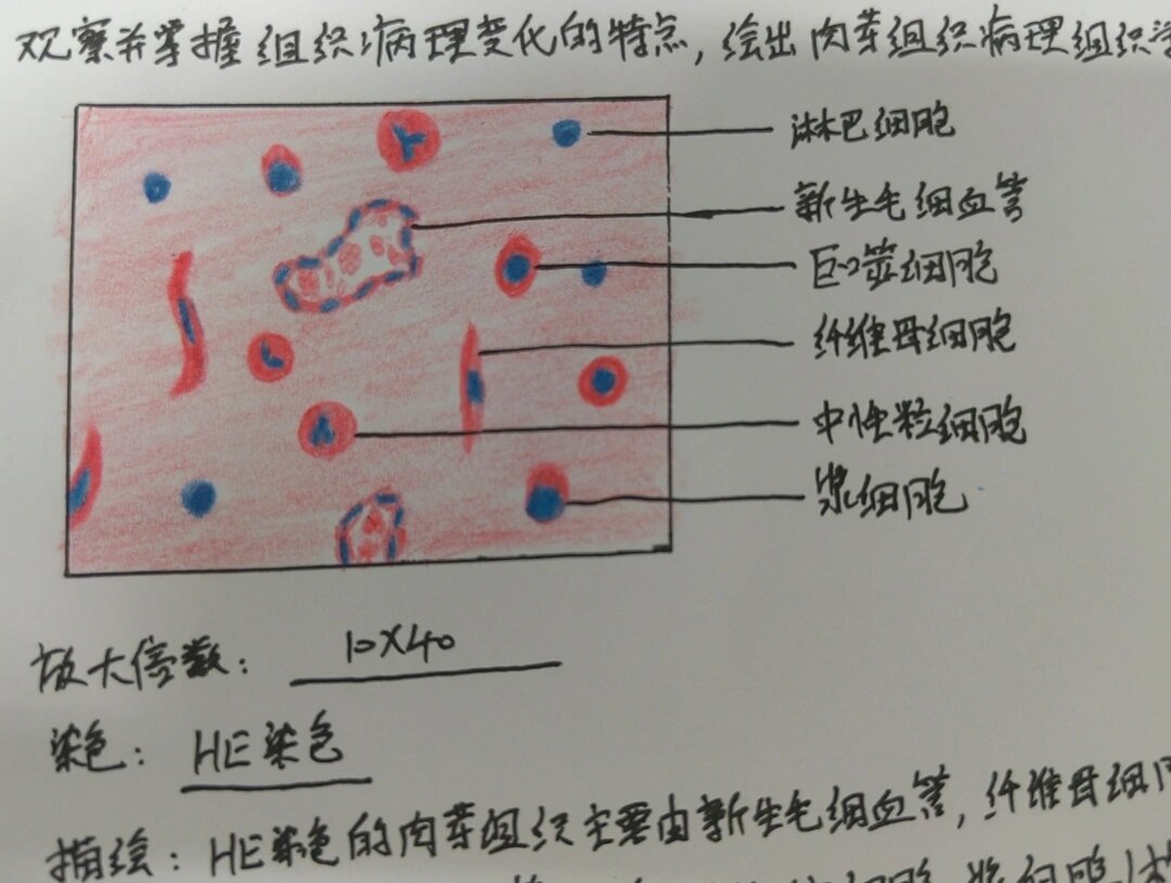 肉芽组织显微镜下图图片