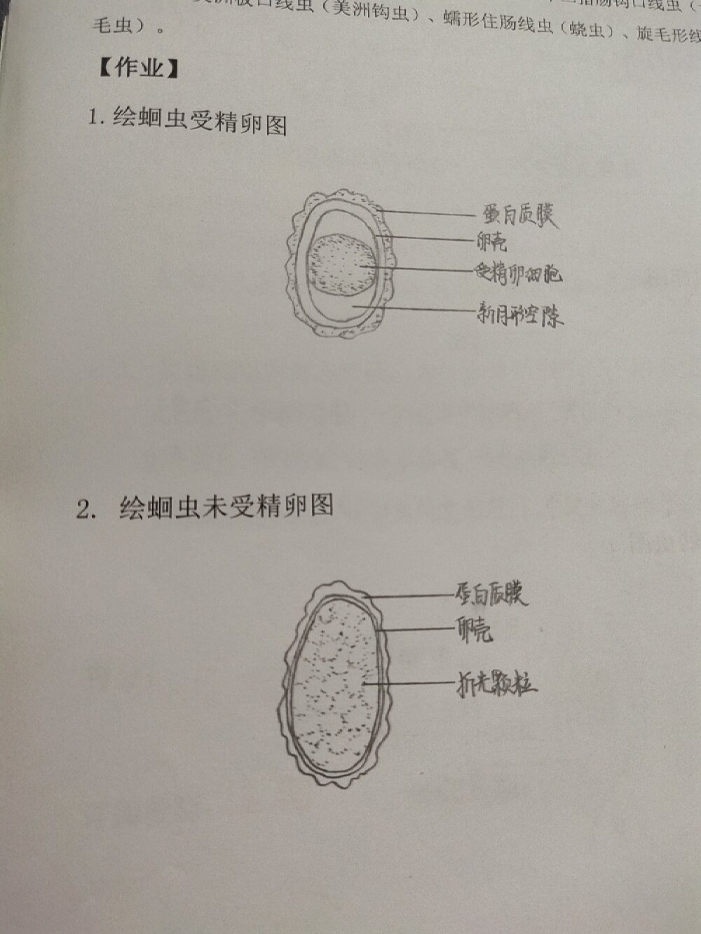 鞭虫卵 结构图片