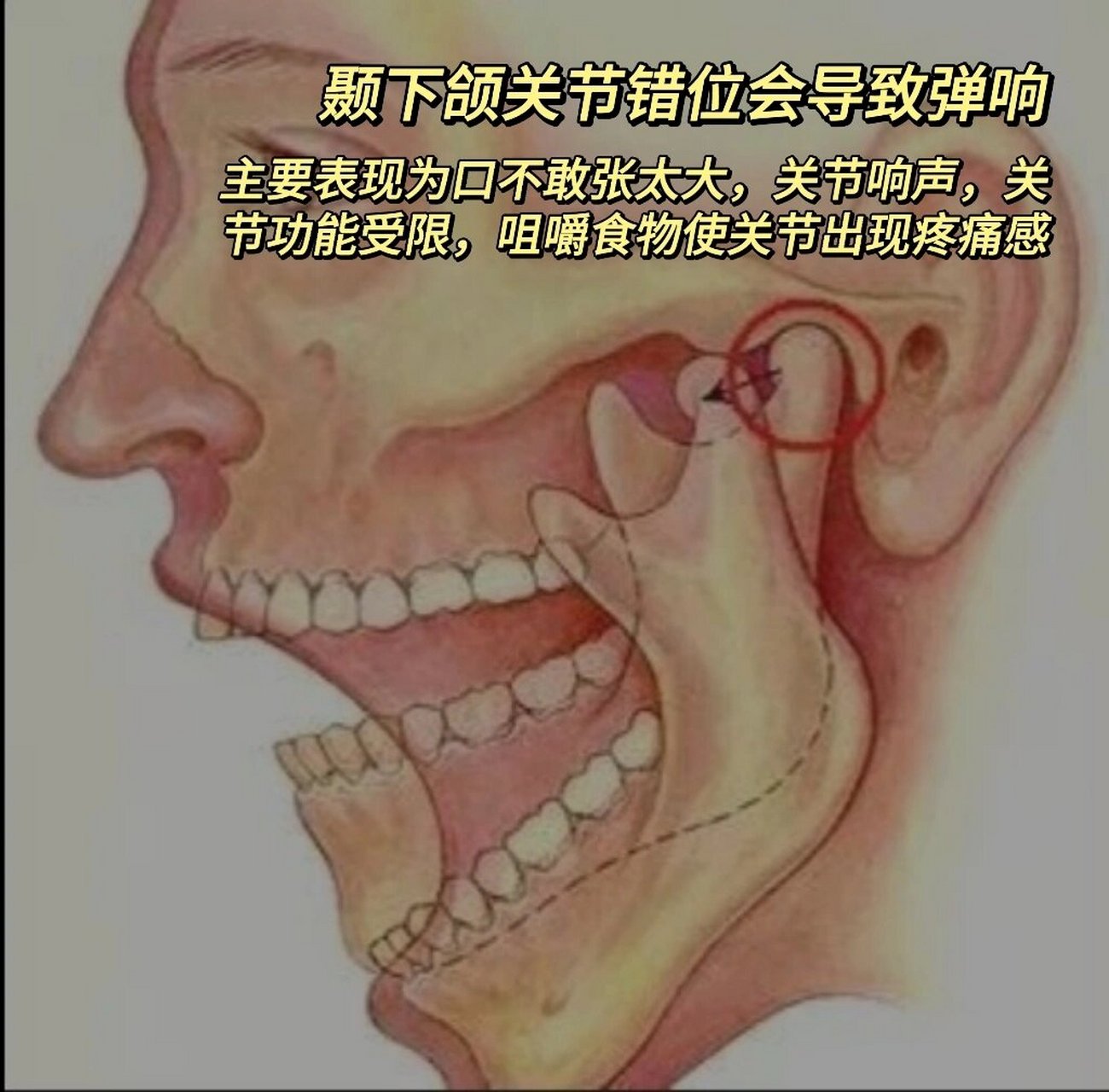 颞下颌关节位置图图片